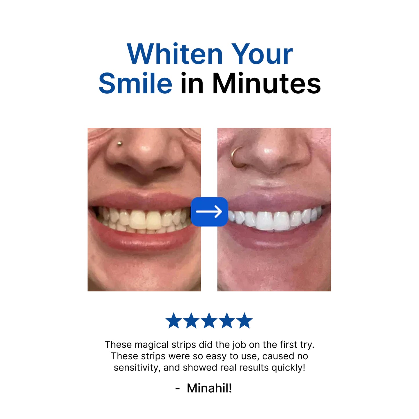 The Original 5D Teeth Whitening Strips